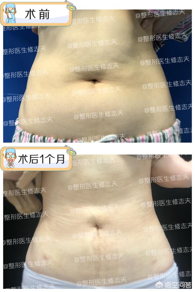 如何轻松减脂<strong>减肥</strong>？