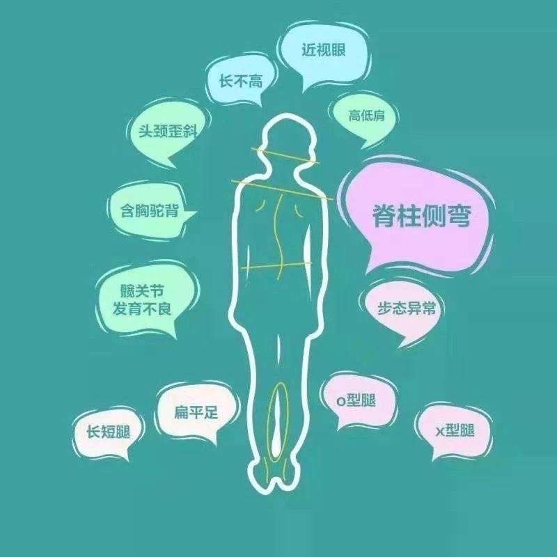 脊柱保健脊柱保健操 恒安医院