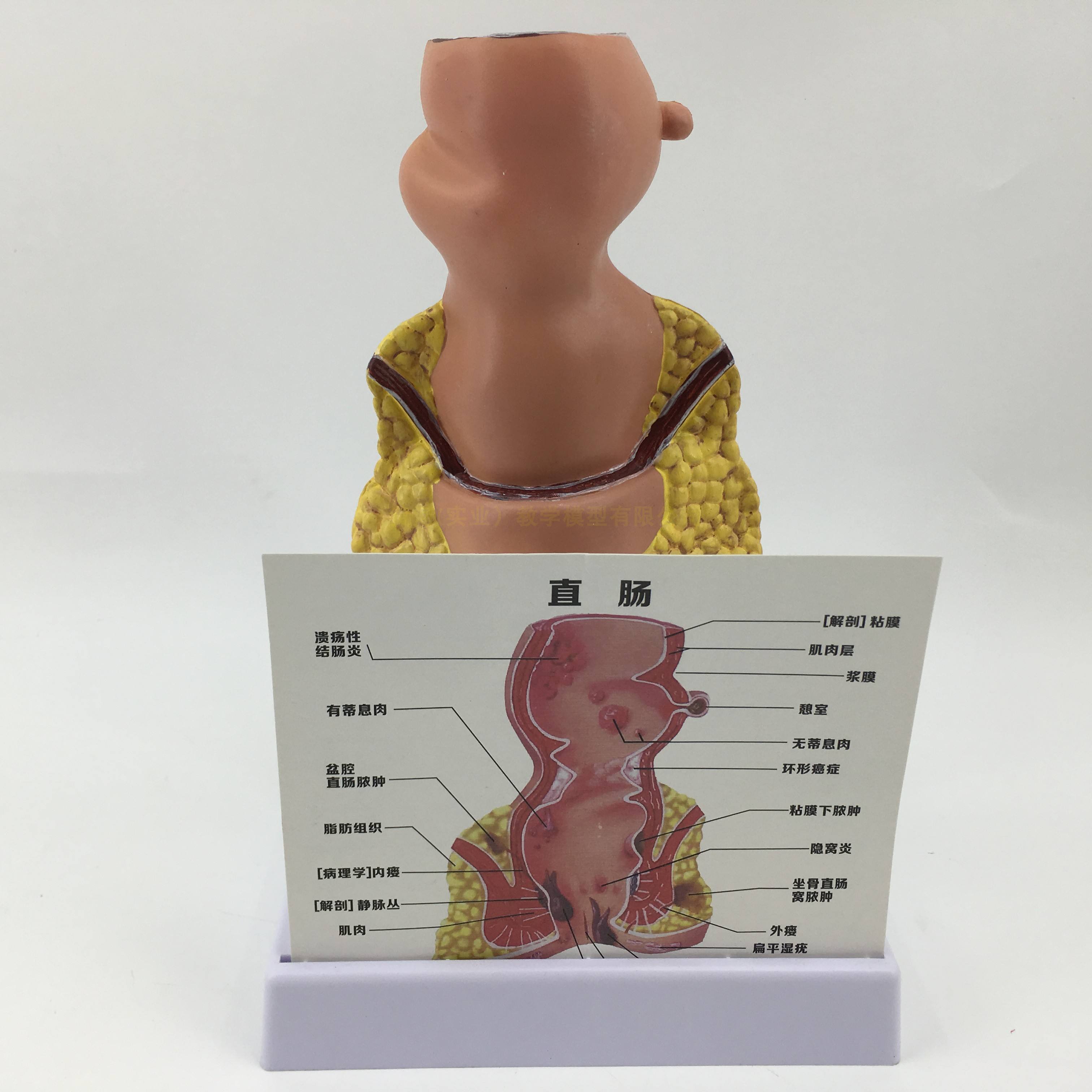 肛门结构图解大全,肛门结构