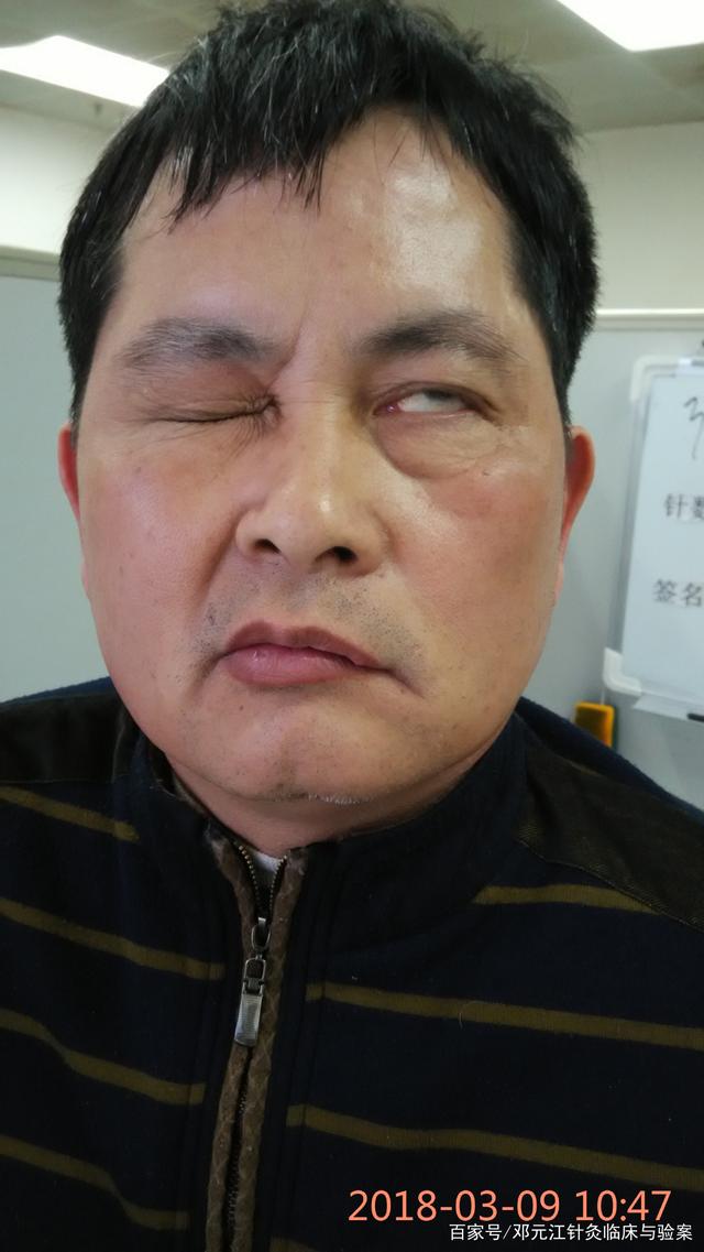 怎样治疗便秘,怎样治疗