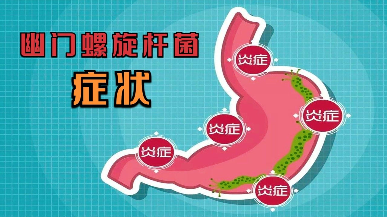 幽门螺杆菌感染症状表现,幽门螺杆菌感染症状表现口臭