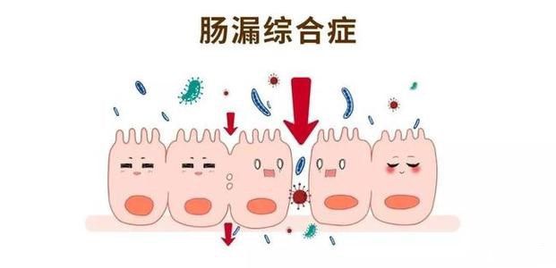 肠子胀气,肠子胀气总觉得有屎拉不出