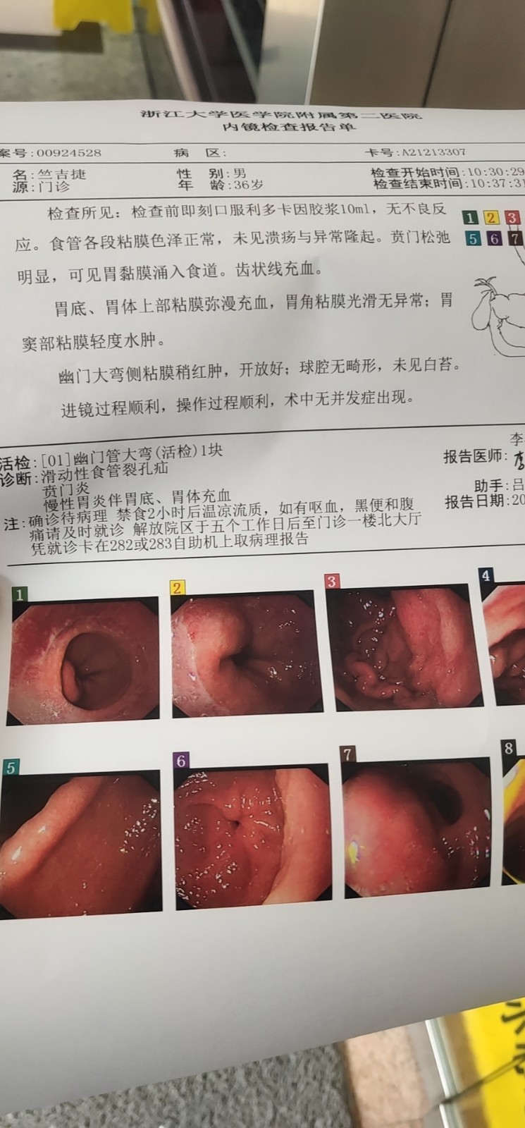 贲门炎贲门炎最怕的三种食物