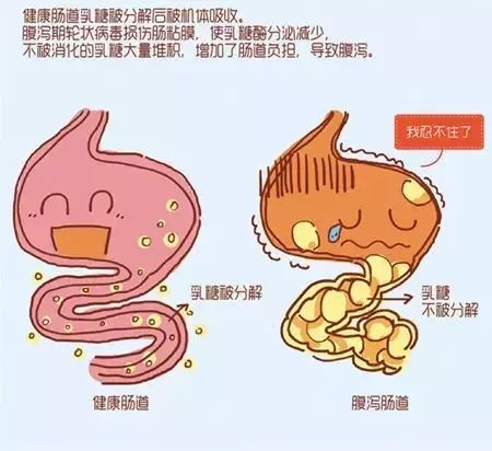 功能性腹泻是什么意思功能性腹泻