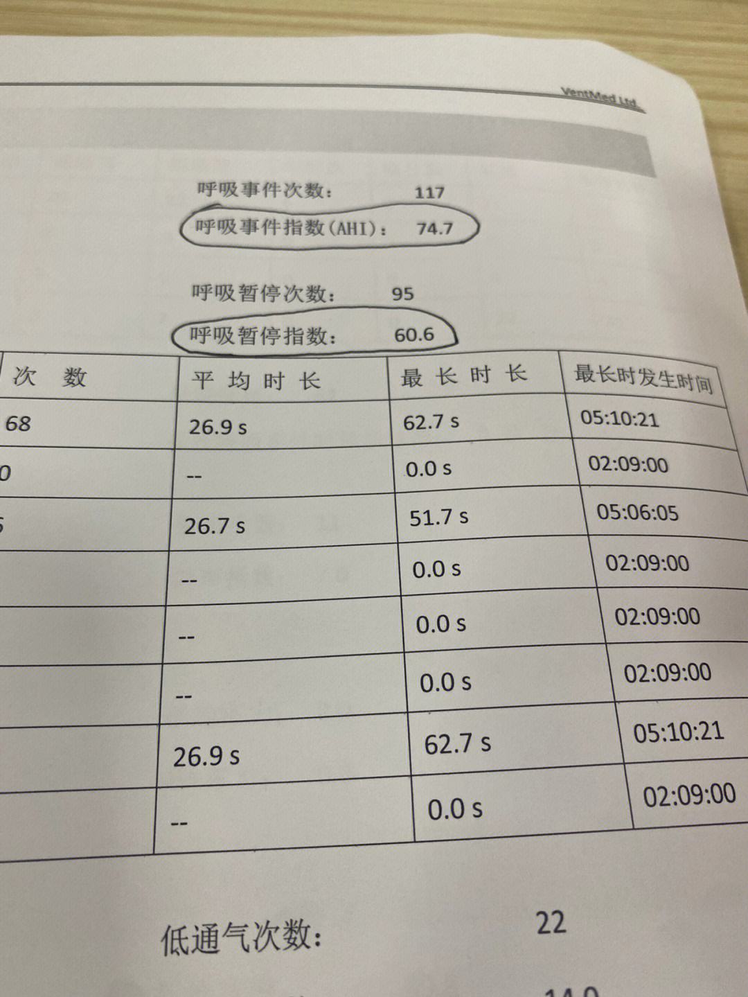 睡眠监测报告分析睡眠监测报告分析模板