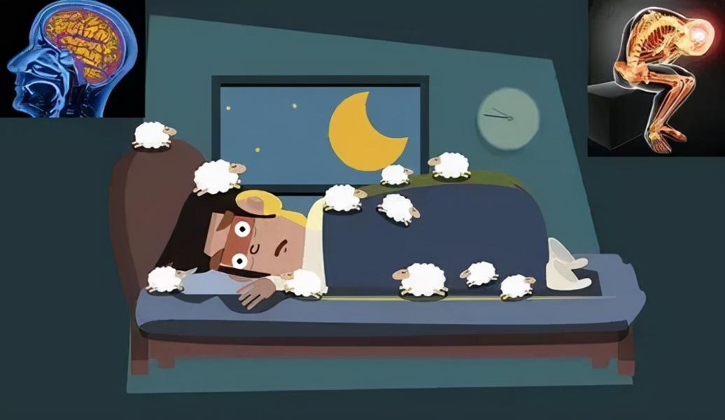 经常睡不着是什么原因经常睡眠不好是什么原因