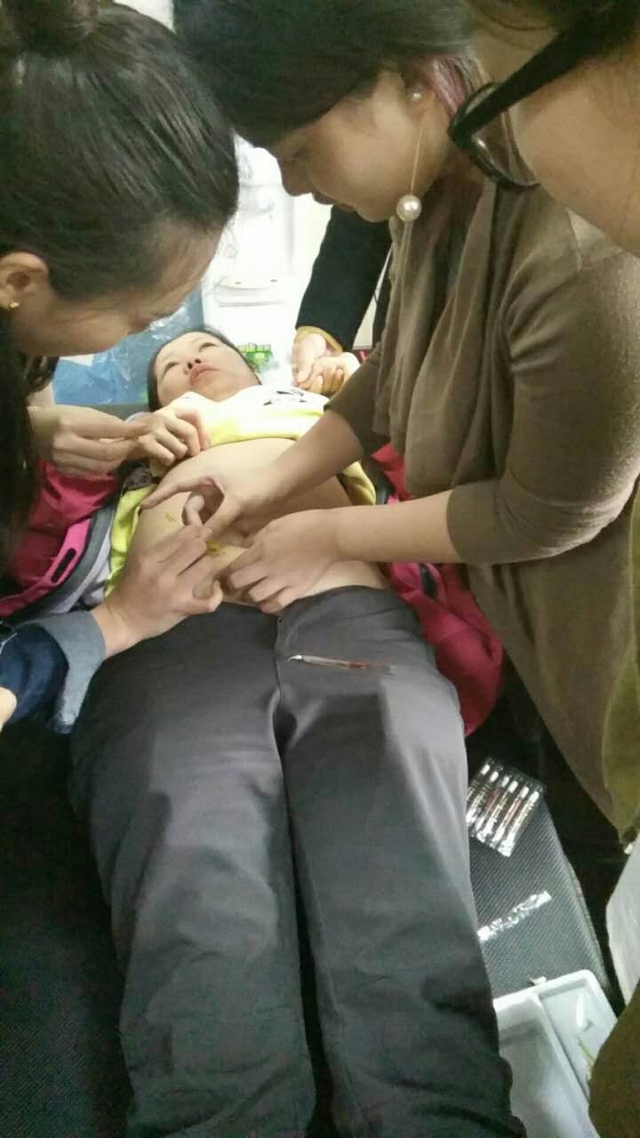 中医减肥埋线怎么埋,中医减肥埋线