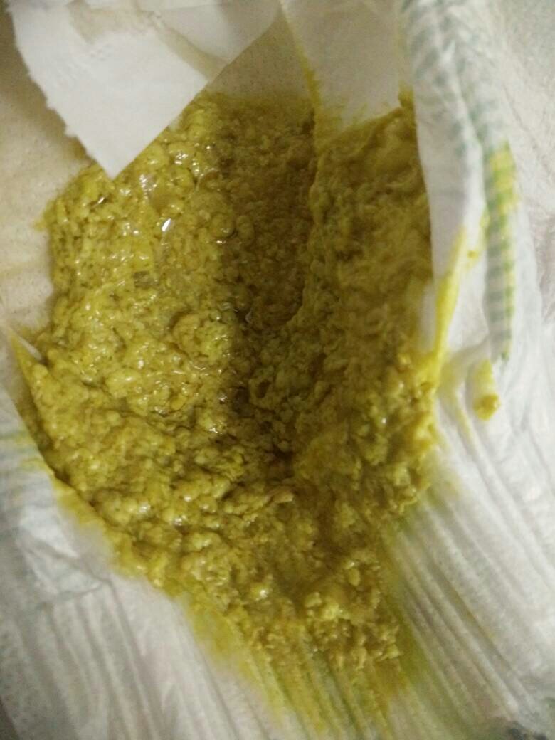 大便先干后稀用什么中成药大便先干后稀