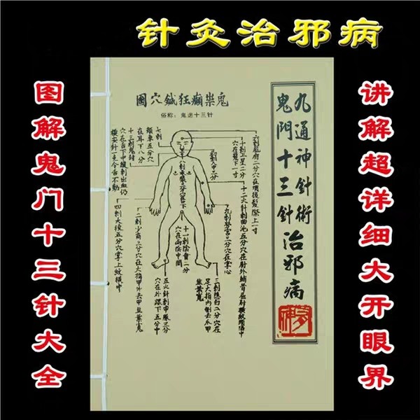 鬼门十三针歌诀鬼门十三针歌诀顺口溜