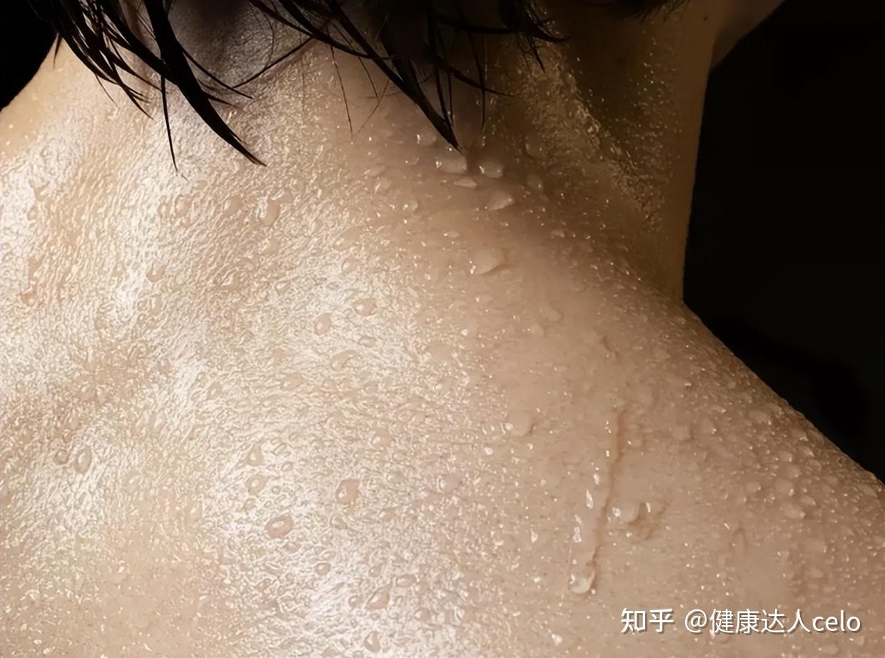 多梦出汗是什么原因,多梦出虚汗是怎么回事