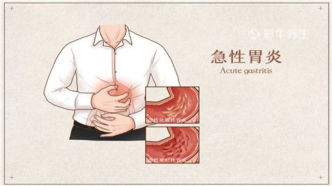 急性胃炎,急性胃炎几天后胃才能恢复正常