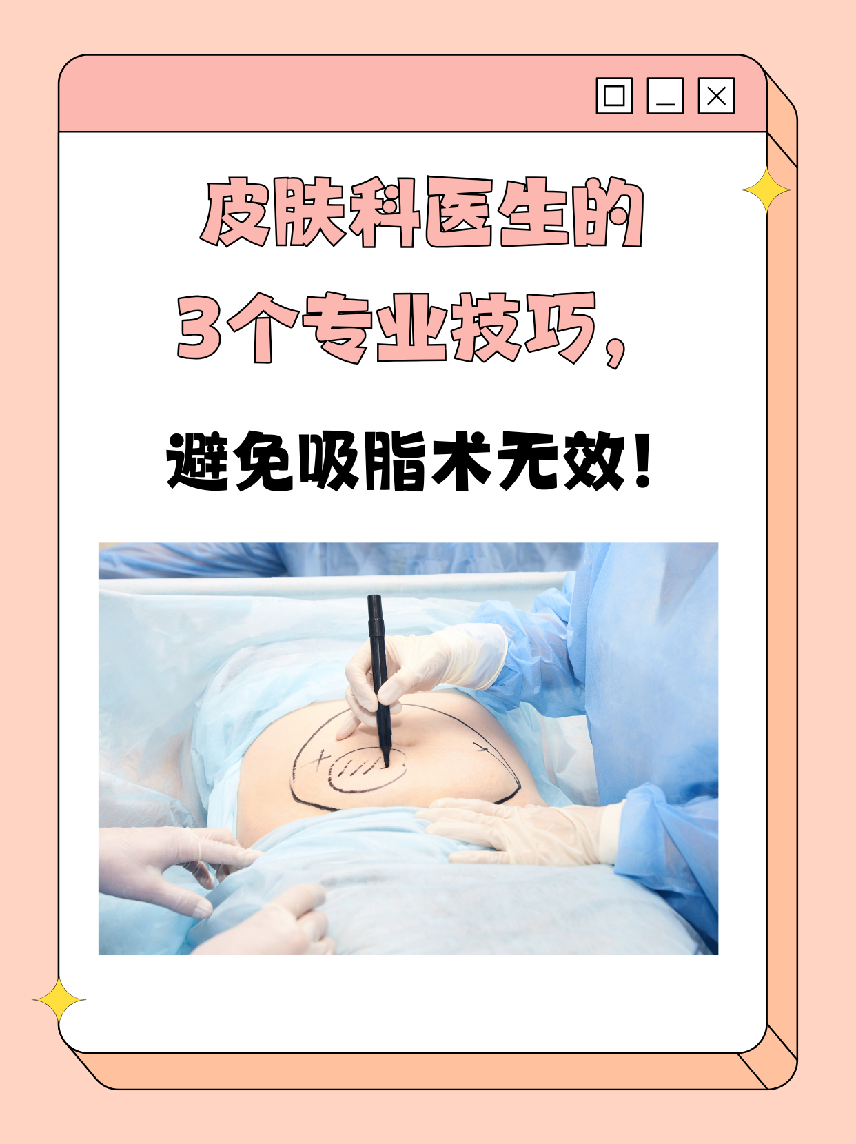 吸脂减肥多少天见效,吸脂减肥多少