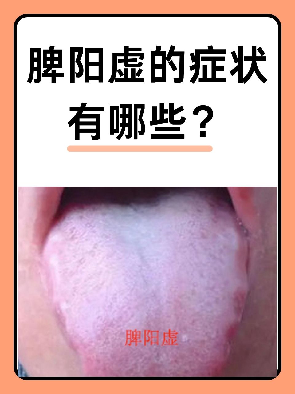 男生阳虚的主要症状阳虚的主要症状