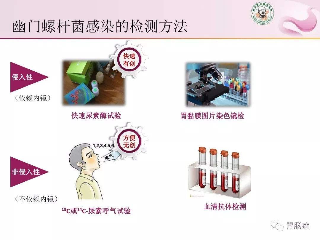 幽门螺旋杆菌哪里可以检查的简单介绍