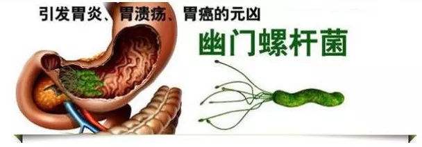 幽门螺旋杆菌的正常值范围,幽门螺杆菌结果840严重吗