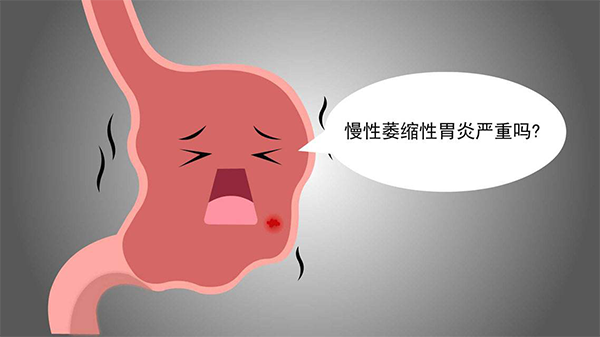 胃炎胃炎必吃三种药