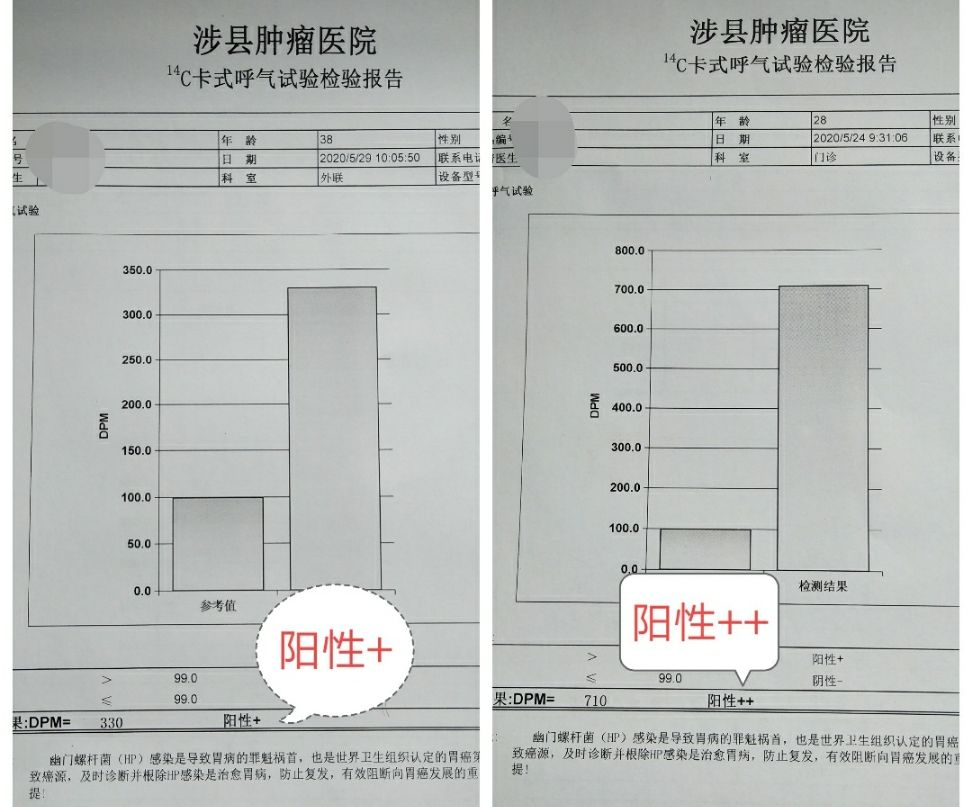幽门螺杆菌的标准值是多少的简单介绍