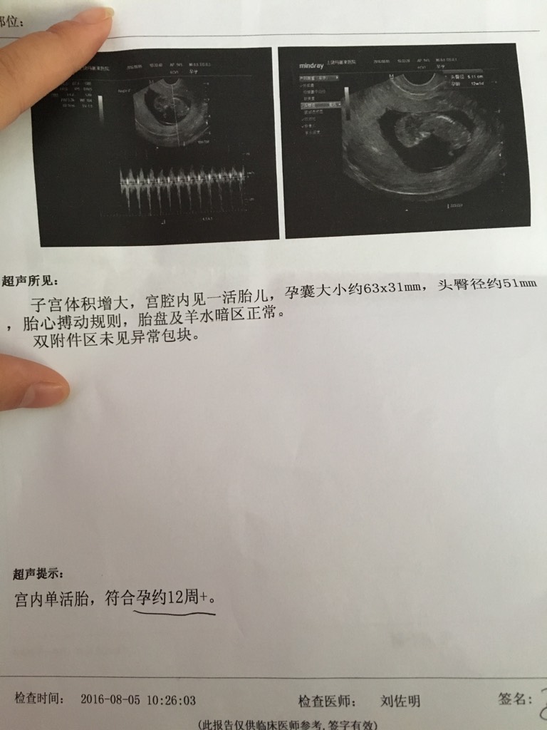 男性彩超怎么检查过程彩超