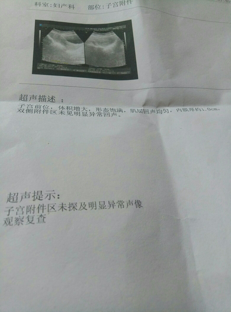 男性彩超怎么检查过程彩超