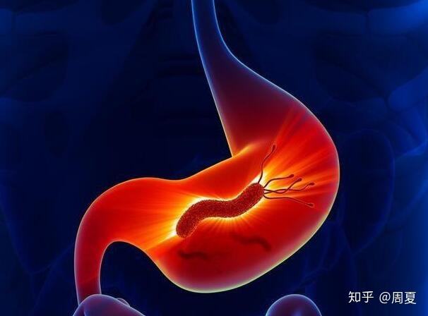关于幽门杆菌是什么病传染吗的信息