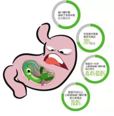 幽门螺旋怎么查幽门螺杆菌怎样检测出来