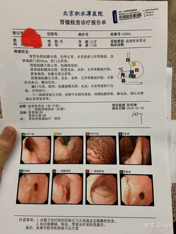 做胃镜到底有多痛苦,照胃镜
