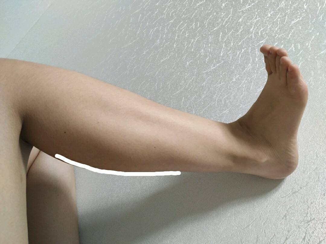 小腿怎么减肥怎样让小腿肌肉瘦下来