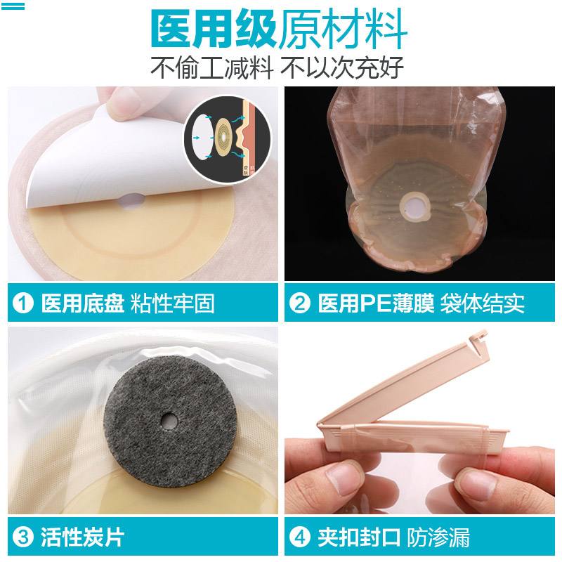人造肛门人工肛造瘘口图片