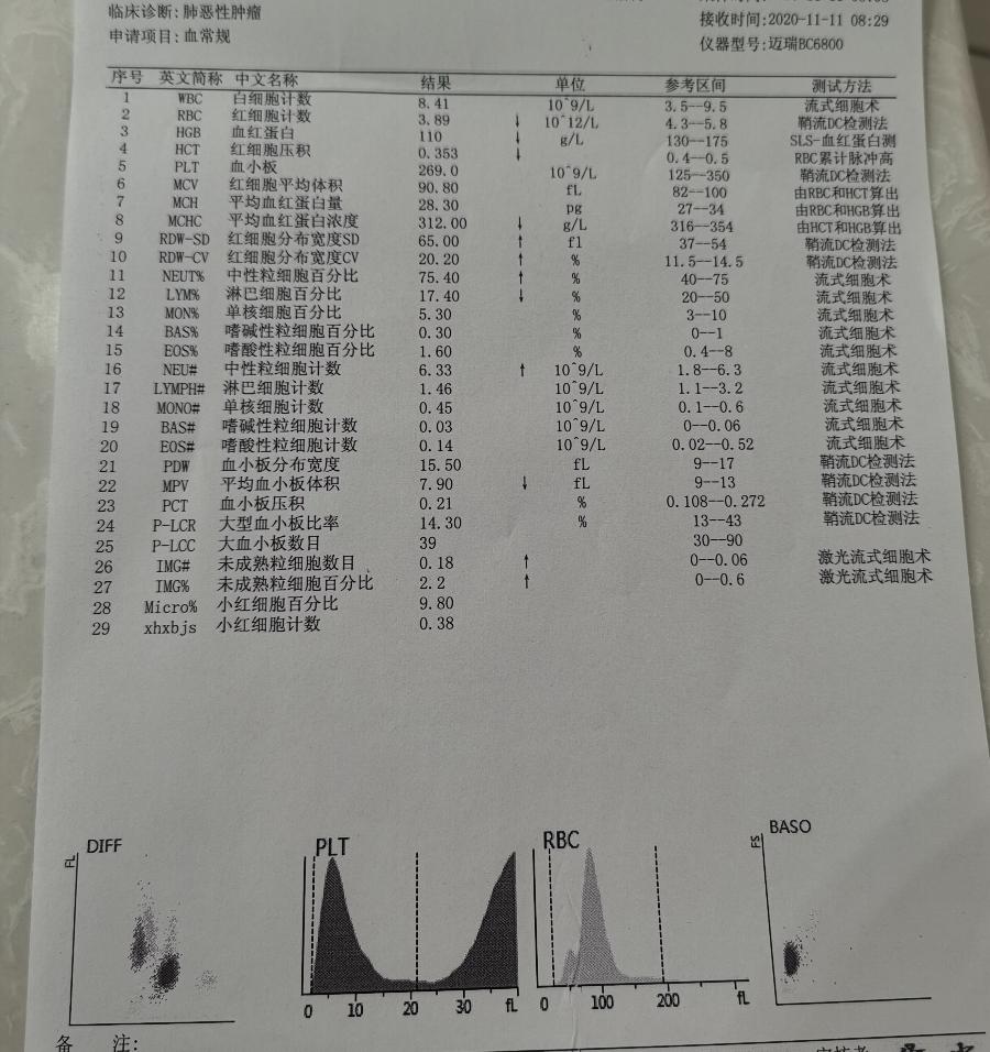 癌胚抗原35算正常吗,癌胚抗原偏高说明什么