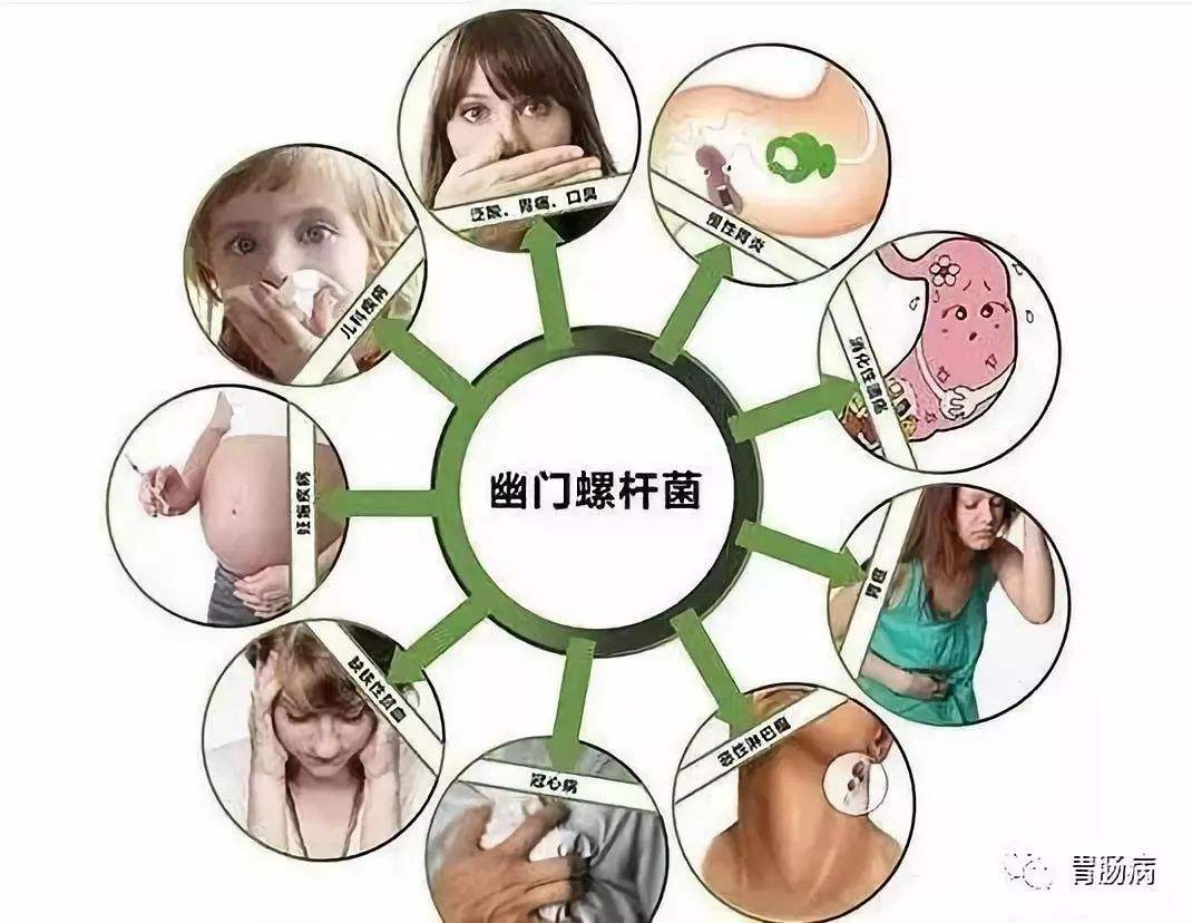 幽门螺旋杆菌吃什么药,幽门螺旋杆菌用什么牙膏