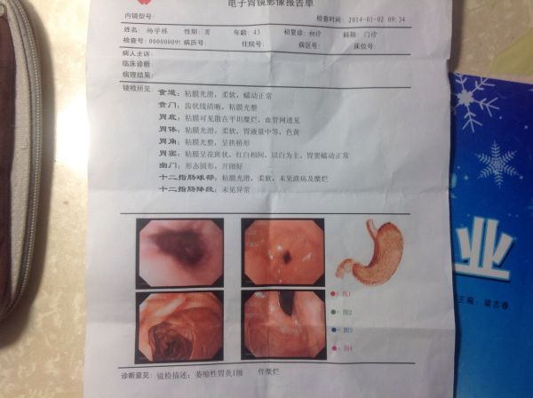 萎缩性胃炎,萎缩性胃炎严重吗
