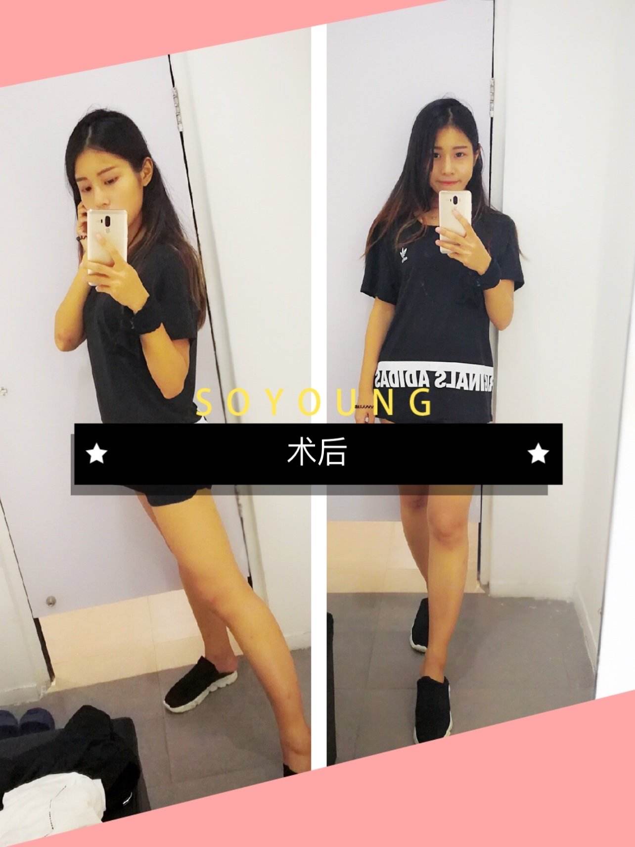腿胖怎么减肥,下半身胖怎么减肥快速