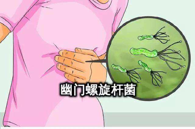 包含幽门螺旋杆菌都有哪些症状的词条