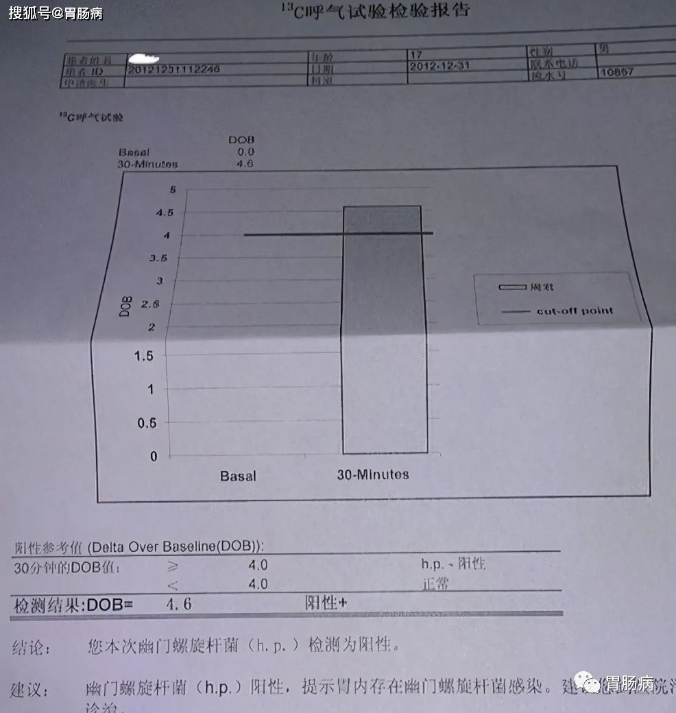 幽门螺杆菌值3000以上严重吗幽门螺杆菌数值多少正常范围