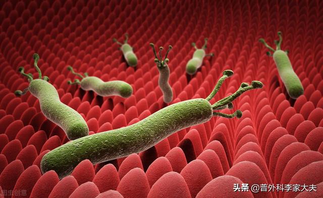 江苏幽门螺旋杆菌家庭筛查 江苏幽门螺旋杆菌家庭筛查