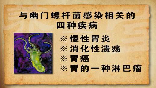 千万不要杀幽门螺杆菌,幽门螺旋菌怎样治疗