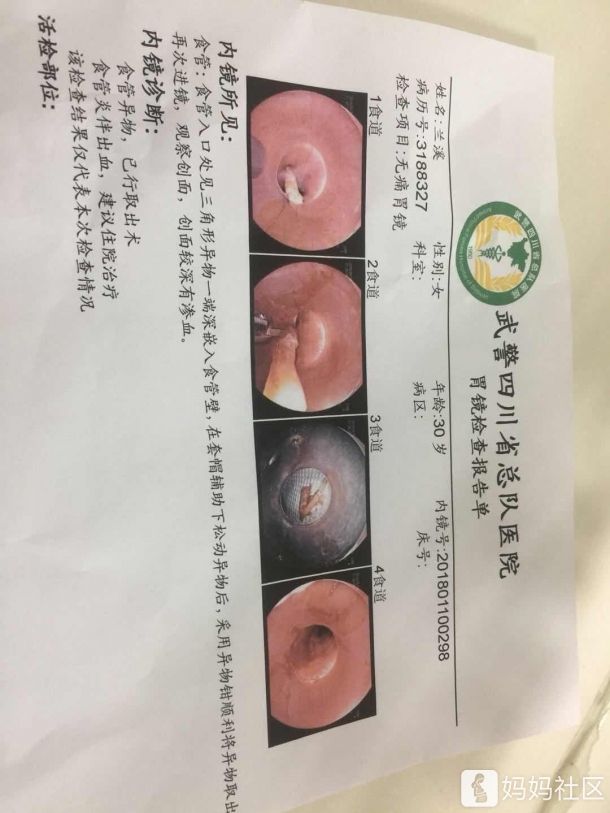 胃镜检查需要多少钱一次,胃镜肠镜检查需要多少钱一次