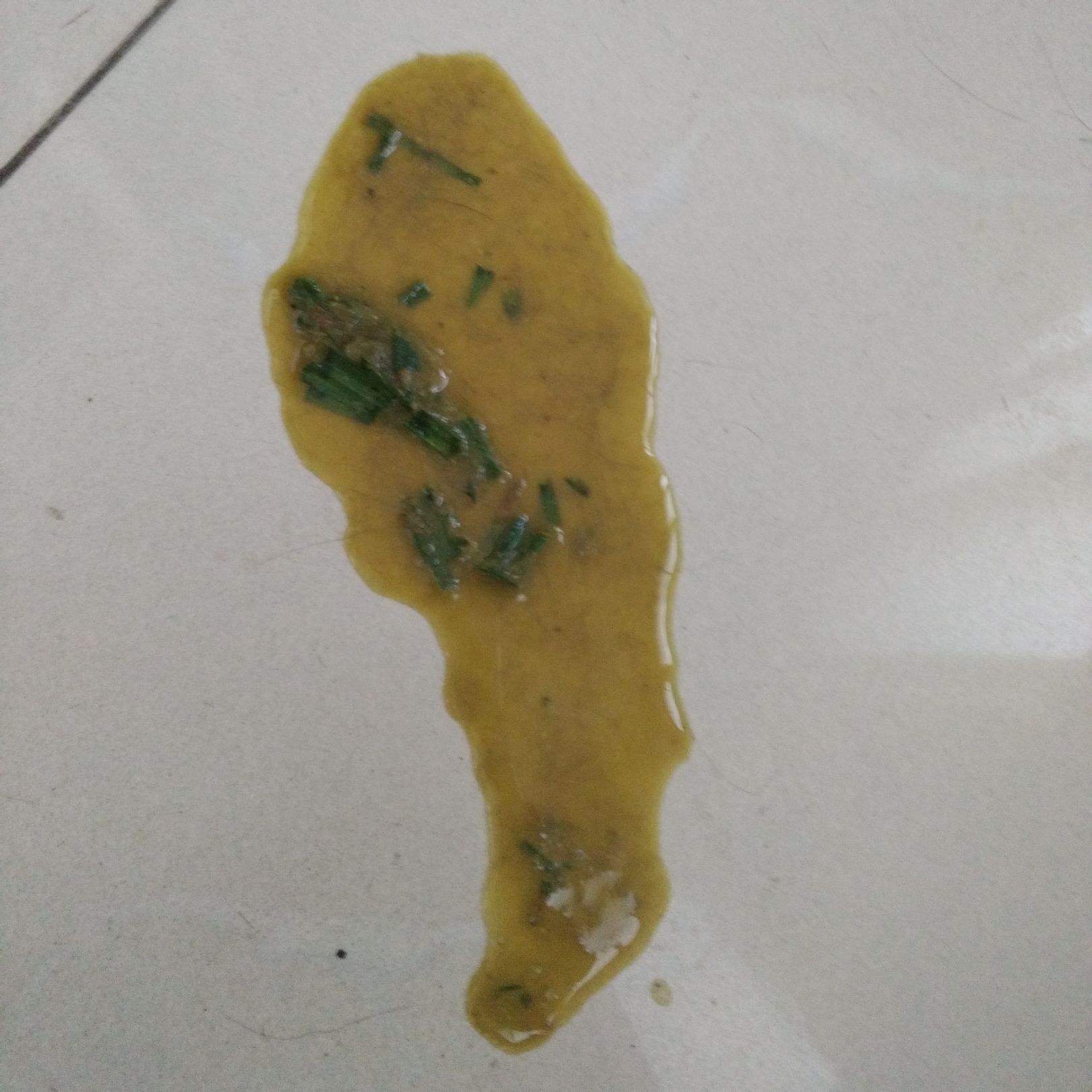 恶心呕吐吃什么药缓解恶心呕吐