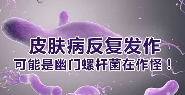 幽门螺旋杆菌会传染给家人吗幽门螺旋杆菌一人得了是不是全家都会传染