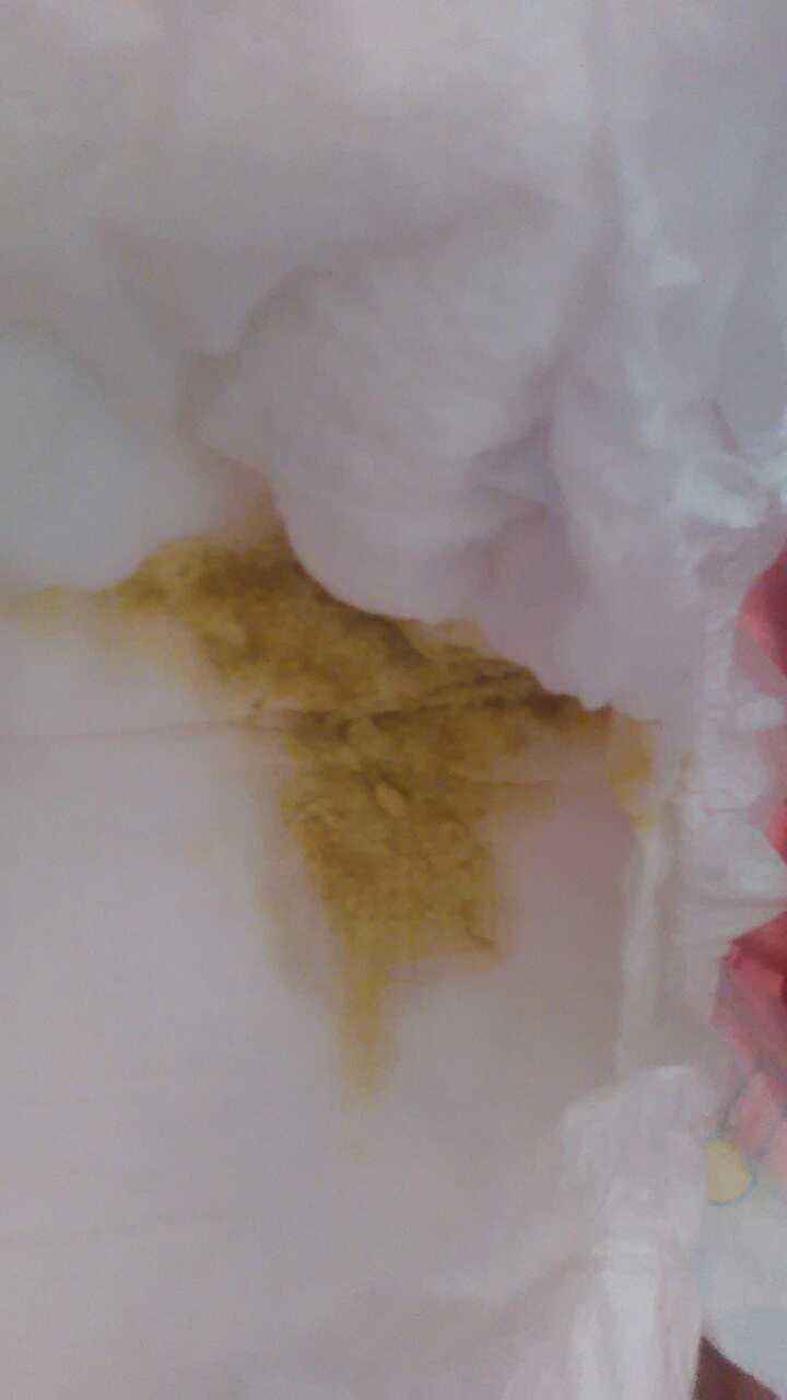 关于拉肚子拉的全是黄稀水肚子还咕咕叫的信息