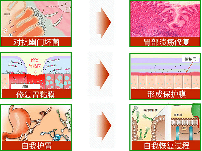 胃幽门螺旋杆菌是什么原因造成的传染吧胃幽门螺旋杆菌是什么原因造成的