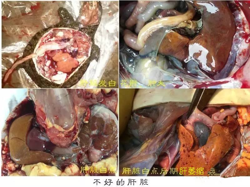 胆胆囊炎的症状是哪里疼