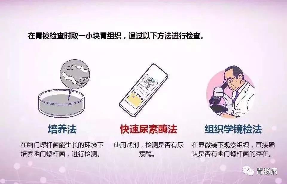 查幽门螺旋杆菌怎么检查,接吻100%会传染幽门螺旋杆菌吗