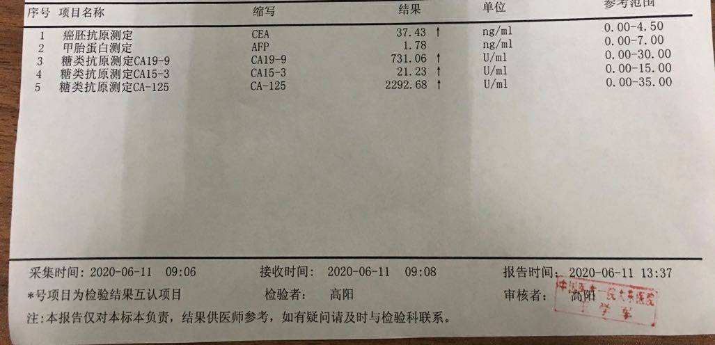 ca125高多少是肿瘤ca125是什么意思