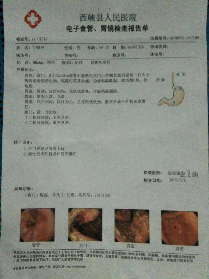 喷门炎早期是什么症状,喷门
