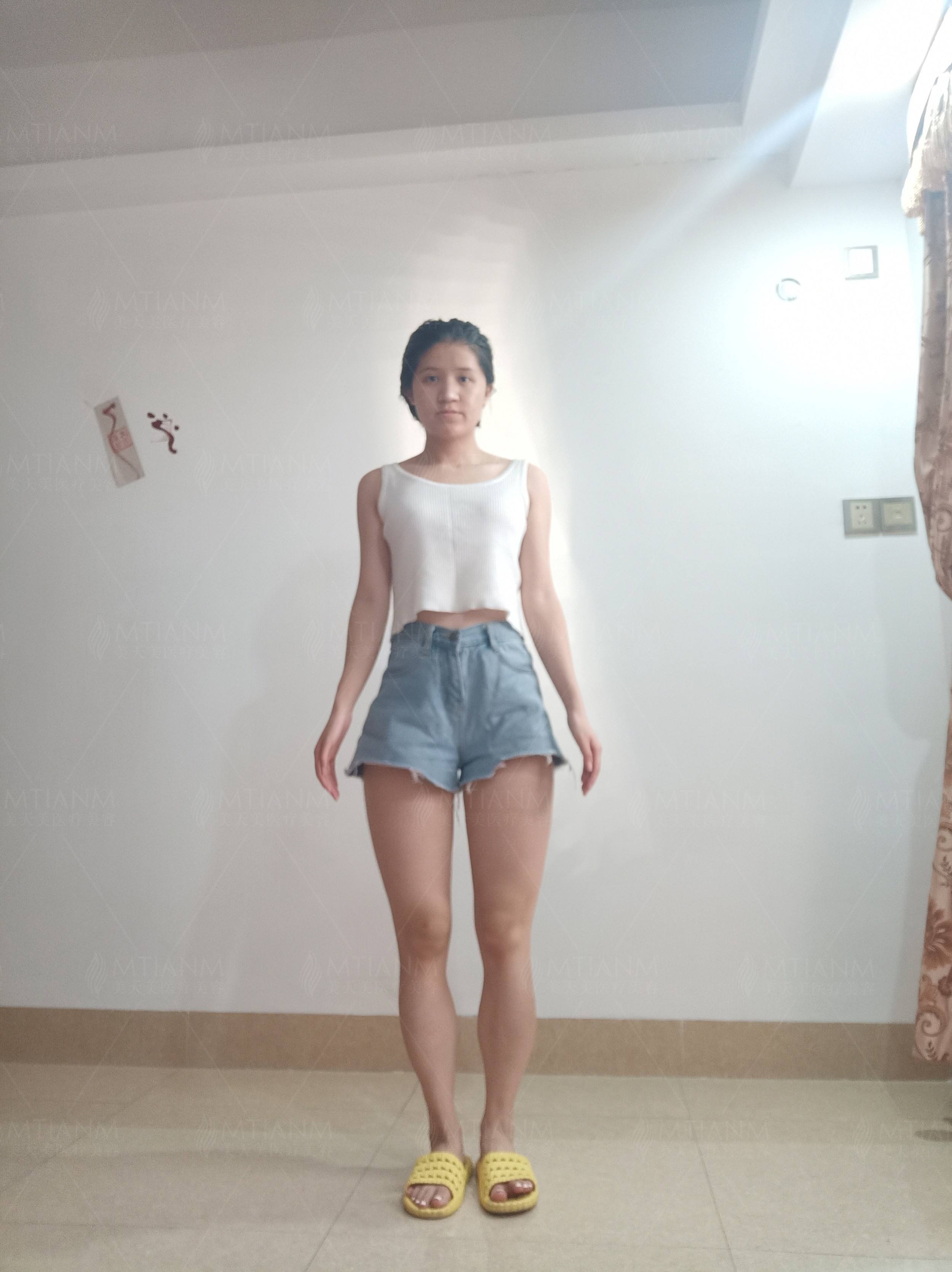 减肥小腿方法小妙招减肥小腿
