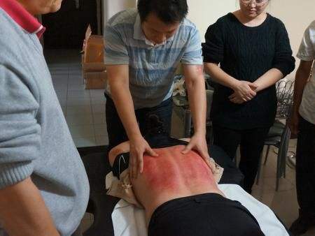 刮痧的正确方法刮痧