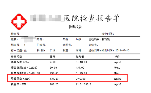 甲胎蛋白是什么意思甲胎蛋白超过5要警惕