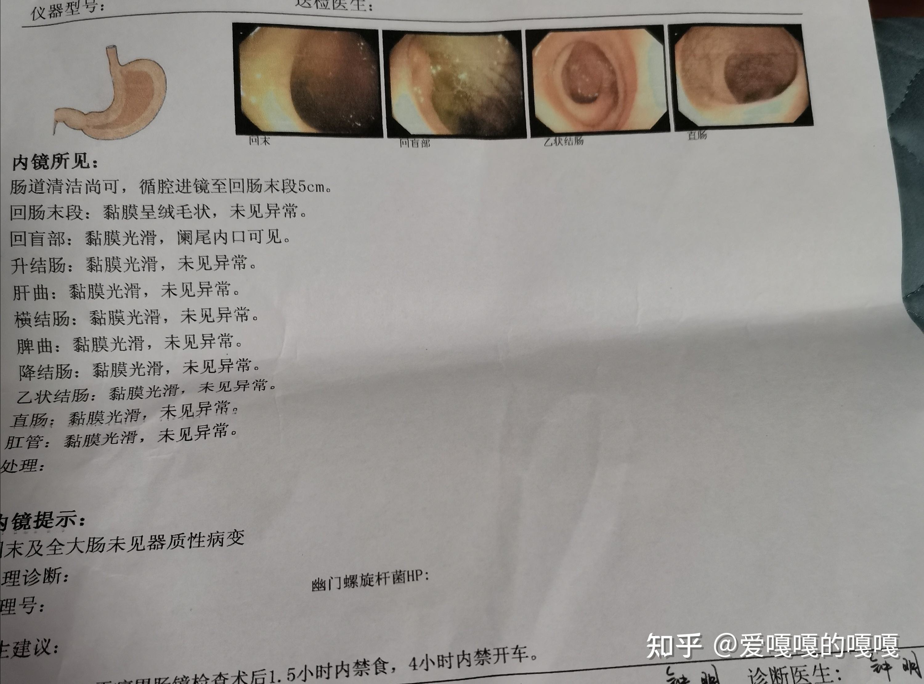 胃镜多少钱,胃镜多少钱检查一次