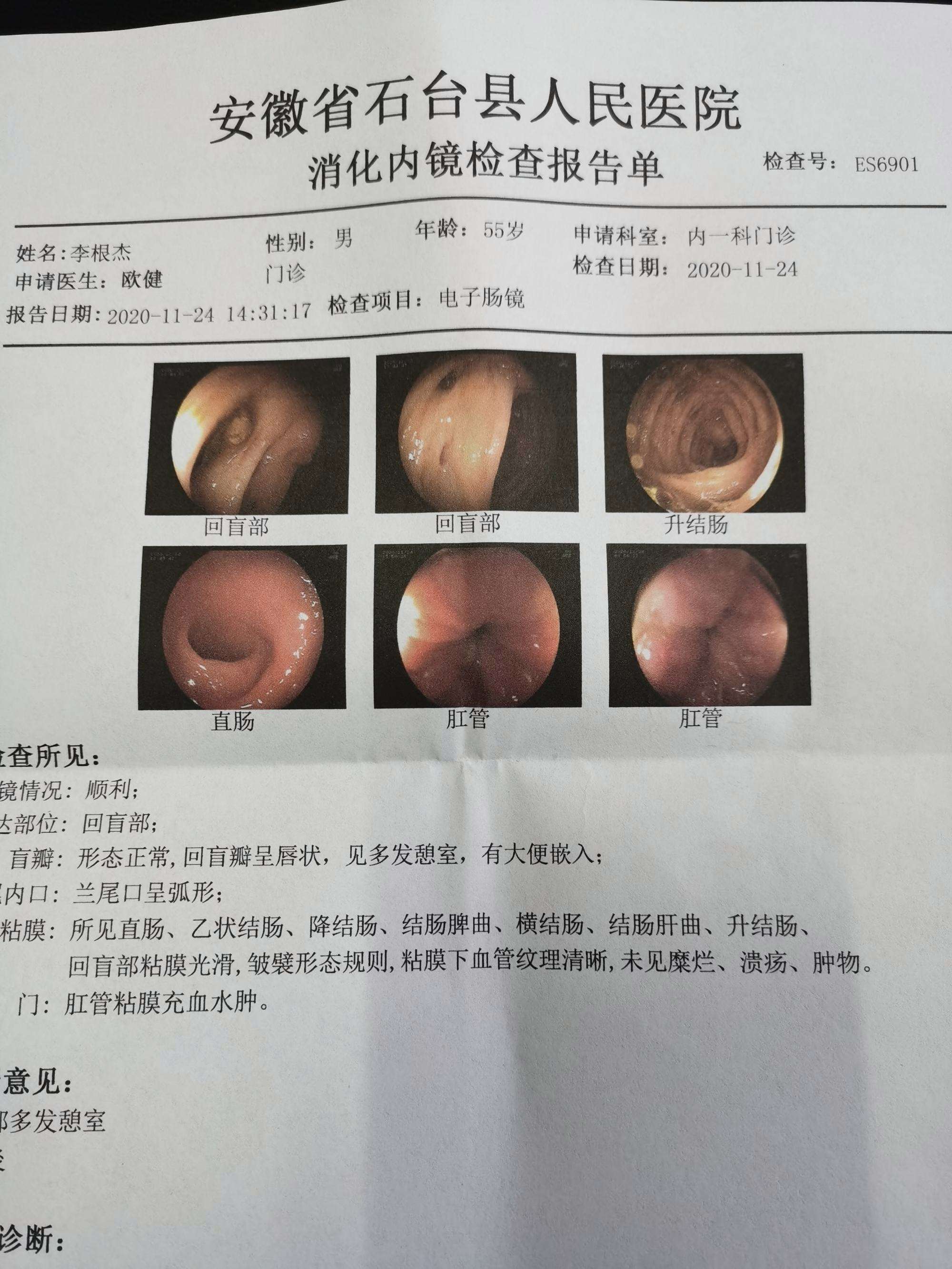 肠镜怎么做痛苦吗时间多久肠镜怎么做痛苦吗时间多久视频